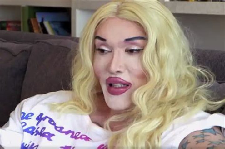 Is Pete Burns Transgender? Gender And Sexuality- Transformation And Surgery