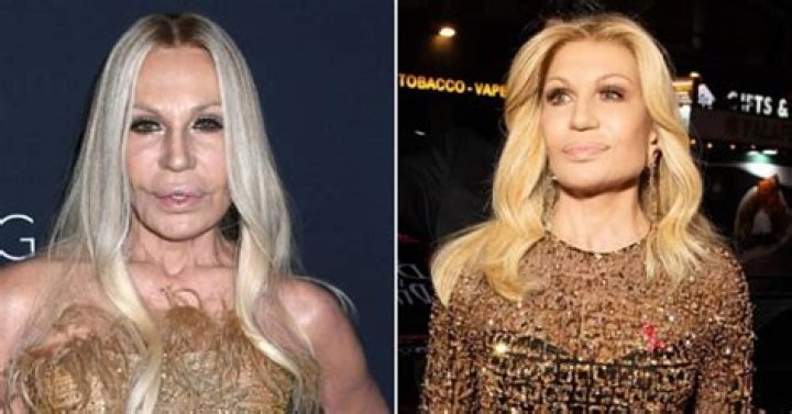 Photos Of Donatella Versace Face Before Plastic Surgery: Grammys 2022 Red-Carpet Look Wows Fans